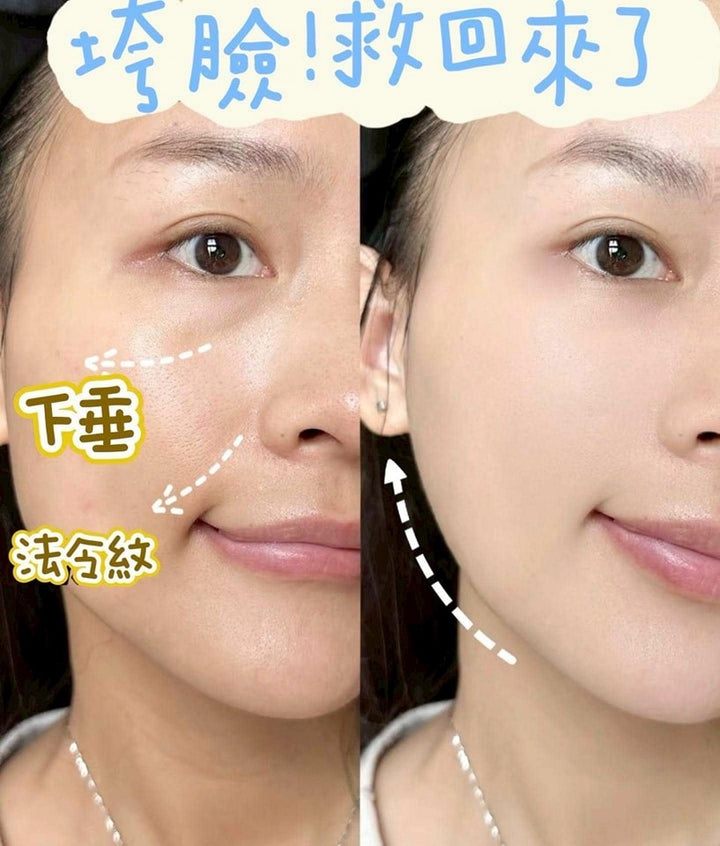 韓國製 🇰🇷 Lefilleo 回春抗皺貼片 (一袋12貼)